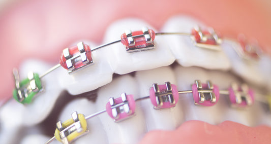 Cracking the Code: Benefits of Tooth Numbering on Orthodontic Bracket Bases