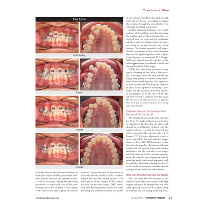 Lucchesi Sub-Slot Brackets