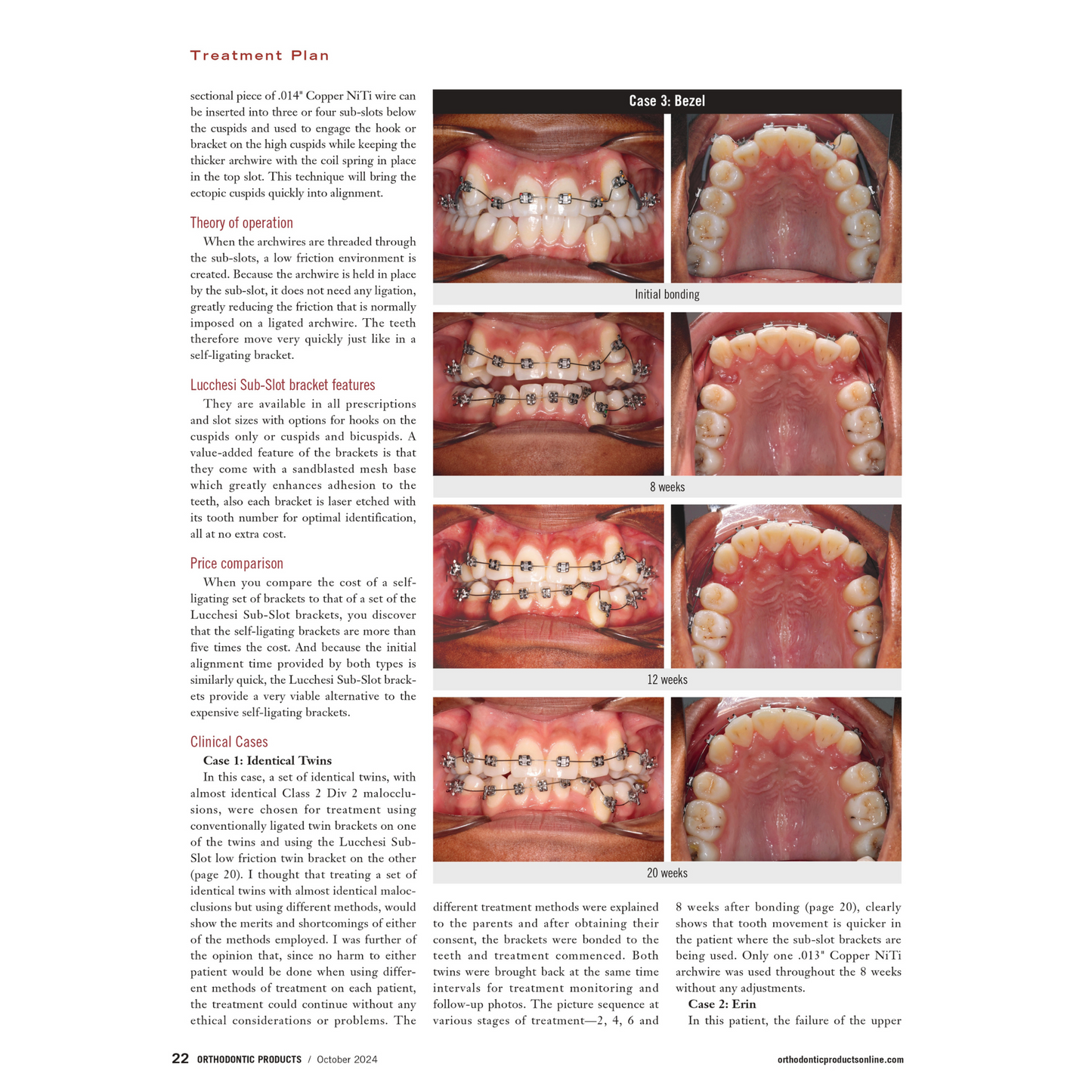 Lucchesi Sub-Slot Brackets